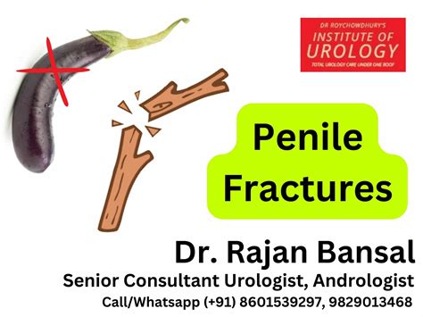 Penile Fracture: What Is It, Causes, Symptoms & Treatment